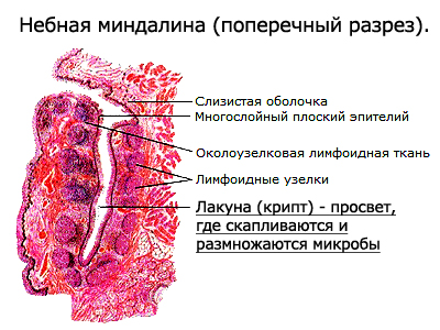 Небная миндалина