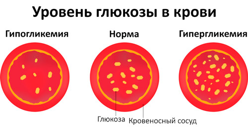 различный уровень глюкозы в крови