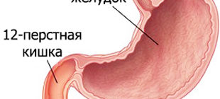 воспаление 12-перстной кишки