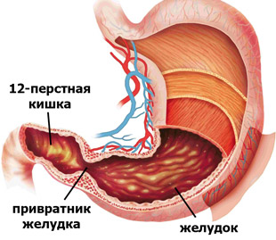 желудок и 12-перстная кишка