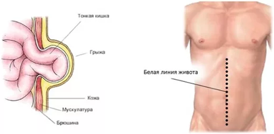 белая линия живота схематично