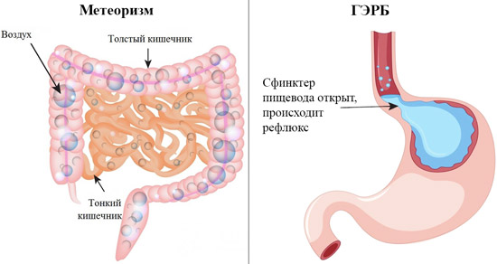 возможные нарушения работы ЖКТ