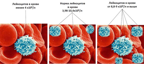 различный уровень лейкоцитов в крови