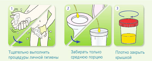 правила сдачи анализа мочи
