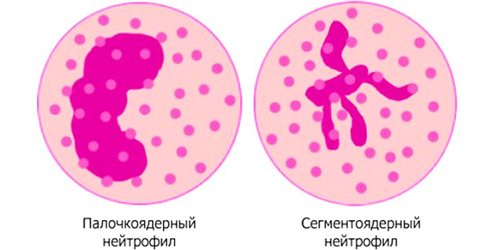 Нейтрофилы под микроскопом