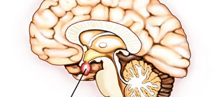 аденома гипофиза головного мозга