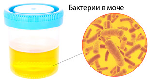 бактерии в анализе мочи