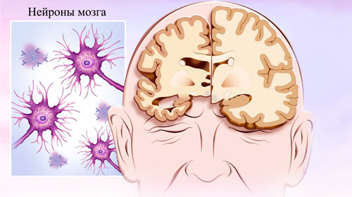 нейроны в мозге человека