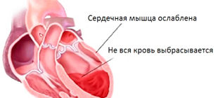 признаки хронической сердечной недостаточности