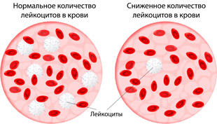 нормальное и пониженое количество лейкоцитов в крови