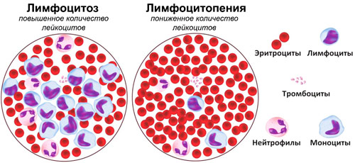 количество лейкоцитов в крови при лимфоцитозе и лимфоцитопении