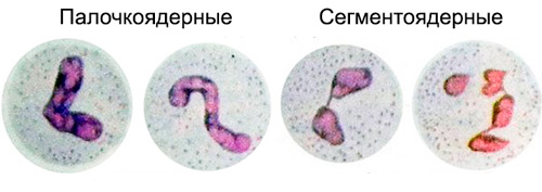 два вида нейтрофилов: палочкоядерные и сегментоядерные