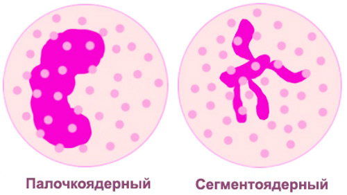 виды нейтрофилов: палочкоядерные и сегментоядерные