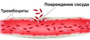 поврежденный сосуд и тромбоциты