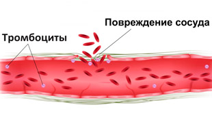 поврежденный сосуд и тромбоциты