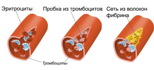 процесс свертывания крови при помощи тромбоцитов