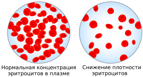 концентрация эритроцитов у здорового человека и при анемии