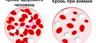 состав крови здорового человека и при анемии