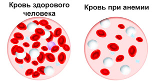 состав крови здорового человека и при анемии