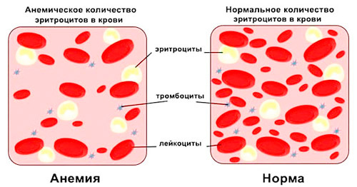 нормальный состав крови и при железодефицитной анемии