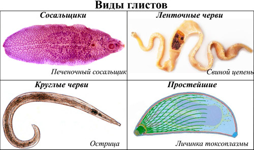 виды глистов у человека: Печеночный сосальщик, Свиной цепень, Острицы, Токсоплазмоз