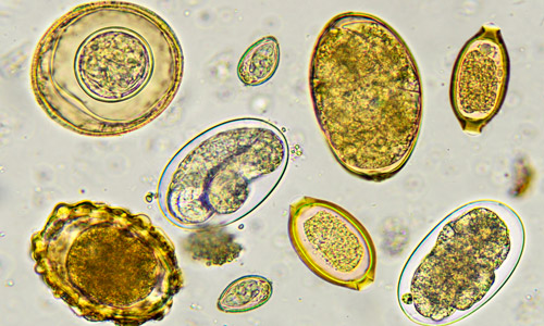 яйца глистов под микроскопом