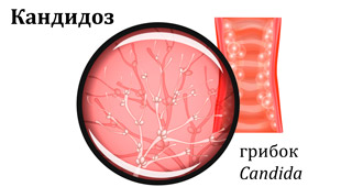 грибок возбудитель кандидоза