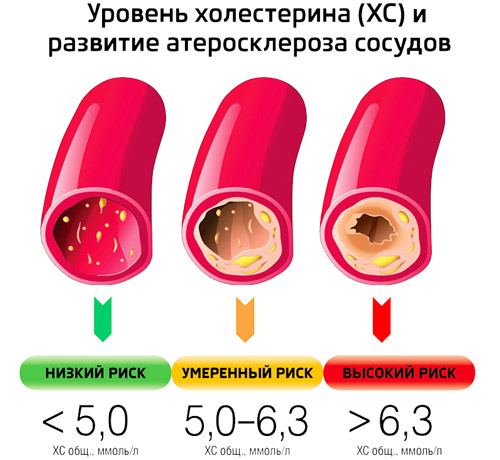 уровни холестерина в крови