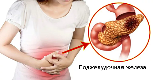 панкреатит - боль в поджелудочной железе