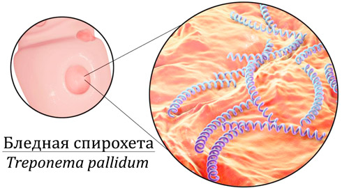 внешний вид бледной спирохеты