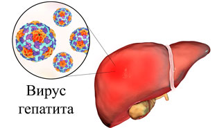 вирус гепатита в печени