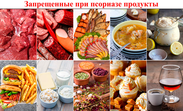 ТОП-10 запрещенных при псориазе продуктов