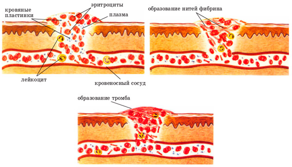 процесс свертывания крови