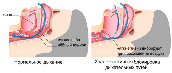 нормальное дыхание и храп